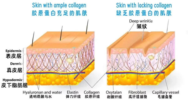 胶原蛋白,补充胶原蛋白,胶原蛋白肽 胶原蛋白,补充胶原蛋白,胶原蛋白肽